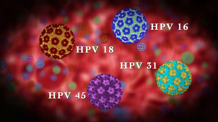 Cach ngan ngua virus HPV gay ung thu, mun coc sinh duc-Hinh-3