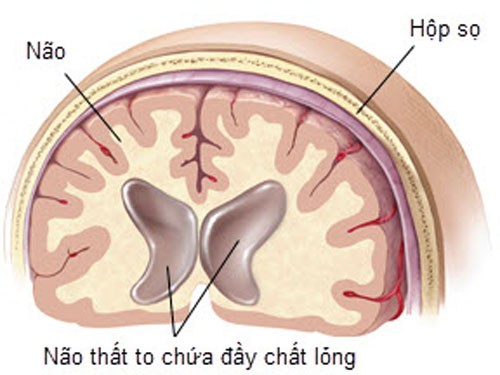 Benh hiem cua Quoc vuong Thai Lan có chũa duọc khong?-Hinh-9