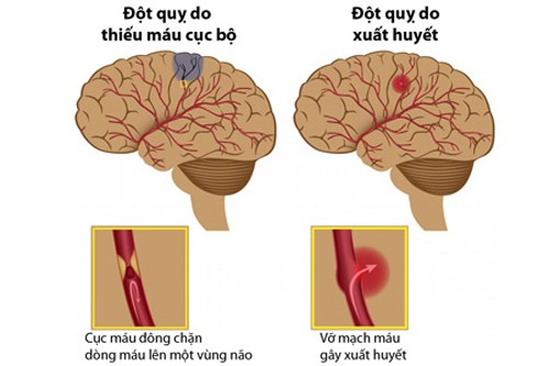 Ngan ngua dot quy toi da bang 8 cach don gian-Hinh-2