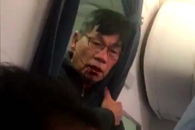 United Airlines se boi thuong the nao cho bac sy goc Viet?