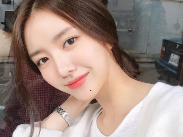 5 not ruoi quy hon vang, du la nam hay nu deu phat tai-Hinh-3