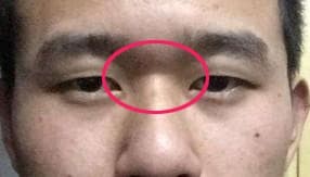 Người có bốn tướng mạo này cả đời sẽ nghèo khó Nguoi co bon tuong mao nay ca doi se ngheo kho