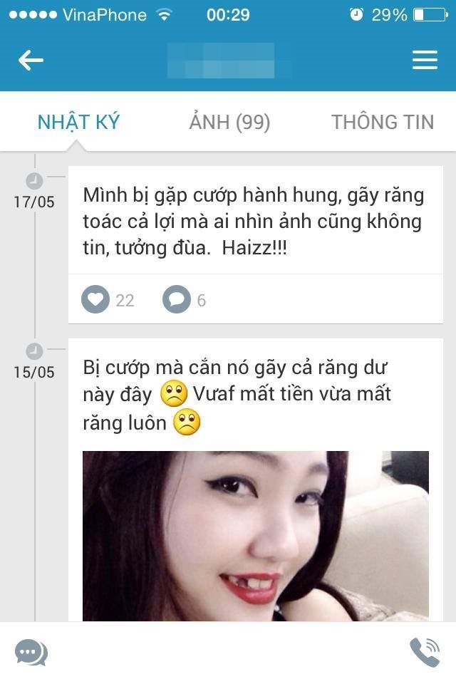 Co nang can cuop gay rang dung iPhone dap lac gay soc-Hinh-4