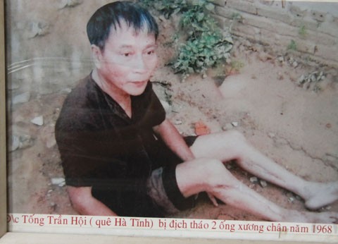 Anh dung toc gay noi “bao tang tra tan” o Phu Xuyen-Hinh-15