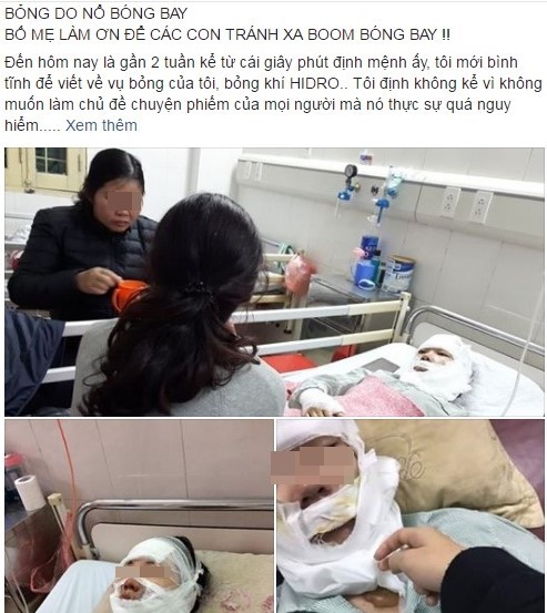 9X bi bong do no bong bay khong mu mat nho deo kinh