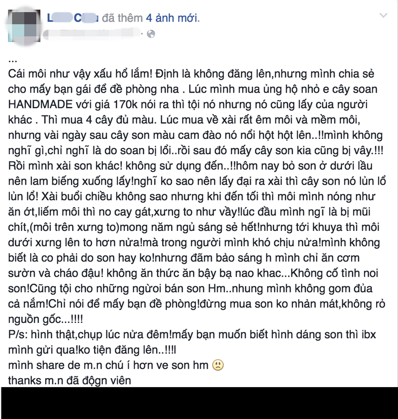 Dung phai son rom, co gai Viet bi sung moi the tham-Hinh-7