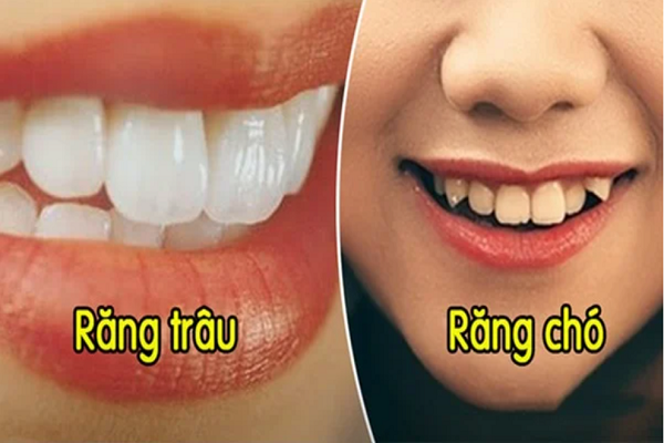 Răng cửa trong hàm răng trâu có những đặc điểm gì?
