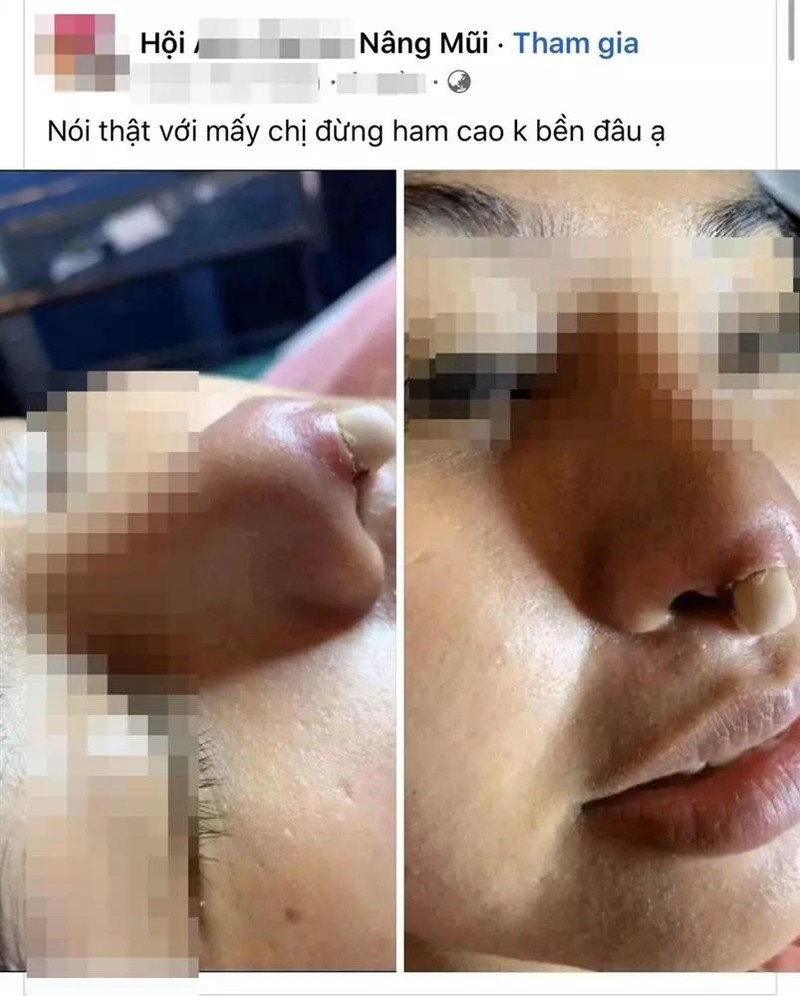 Co gai gay hai hung khi nhin thanh qua cua man nang mui-Hinh-3