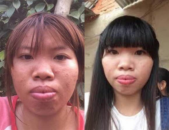 Phuong Thi No bao tin vui lan 3, dan mang tap nap vao chuc mung