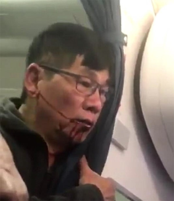 Ong David Dao duoc boi thuong bao nhieu neu thang kien United Airlines?