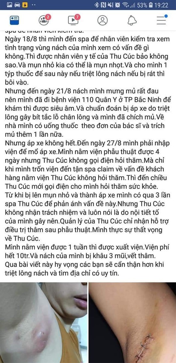 BV Thu Cuc “choi kho” tuyen nu VN bang voucher dao keo... con dinh phot gi?-Hinh-2