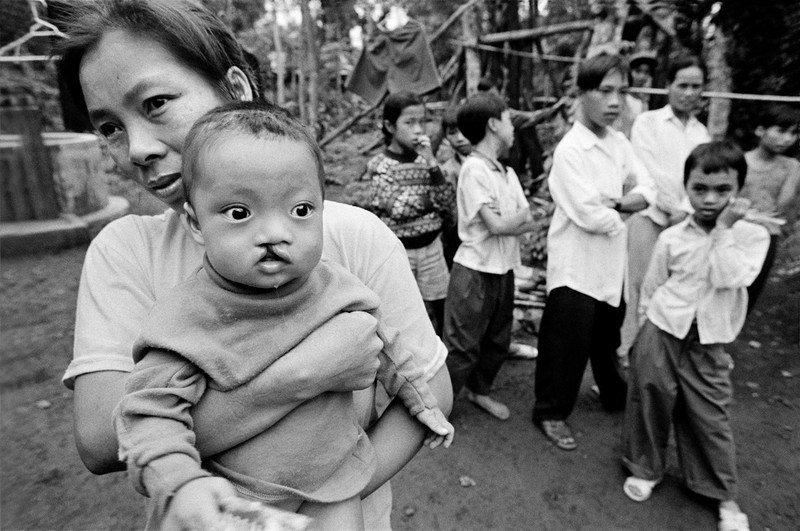 Hinh anh khung khiep ve “noi dau da cam” thap nien 1990 (1)-Hinh-7