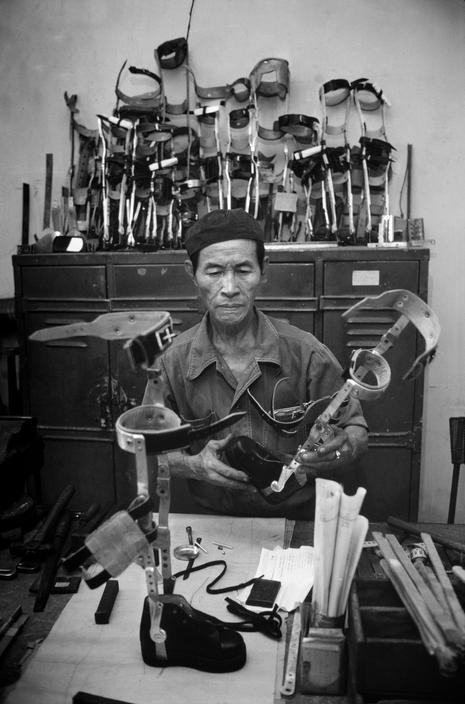 Anh quy ve nguoi thuong binh Viet Nam nam 1980-Hinh-10