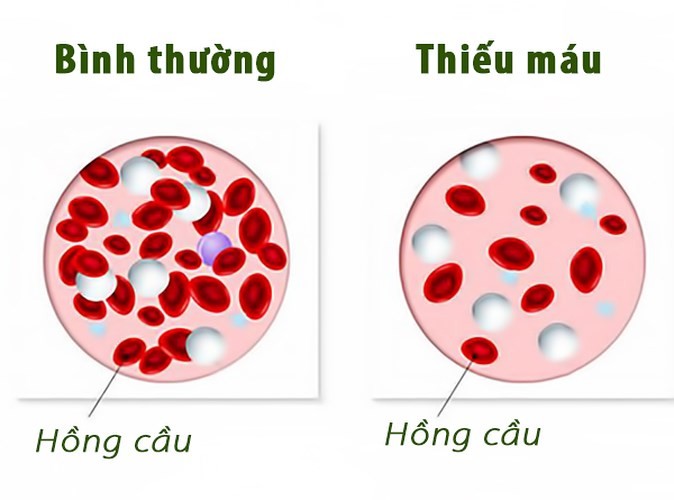 Co the phu nu thay doi ra sao sau khi cat bo tu cung?-Hinh-3