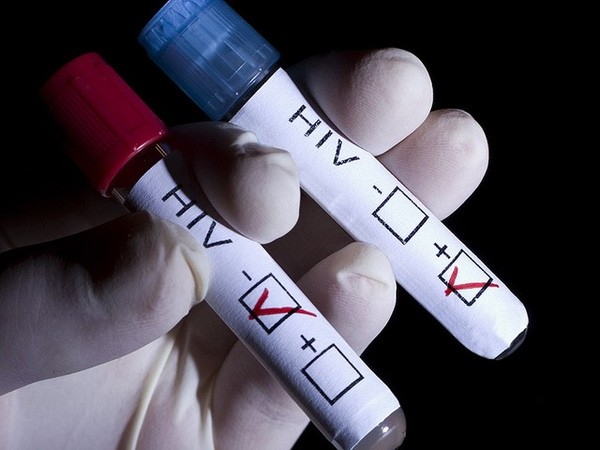 Virus HIV duoc liet vao danh sach chat gay ung thu-Hinh-4
