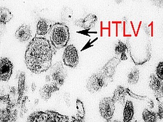 Virus HIV duoc liet vao danh sach chat gay ung thu-Hinh-5