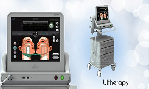 Ultherapy cho ve dep thang hoa cung thoi gian