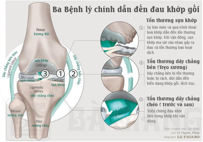 Thoi tiet lanh, am thap: ke thu cua benh xuong khop-Hinh-2