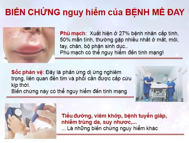 Bai thuoc Nam cua nguoi Viet “danh bay” me day man ngua trong tich tac-Hinh-2