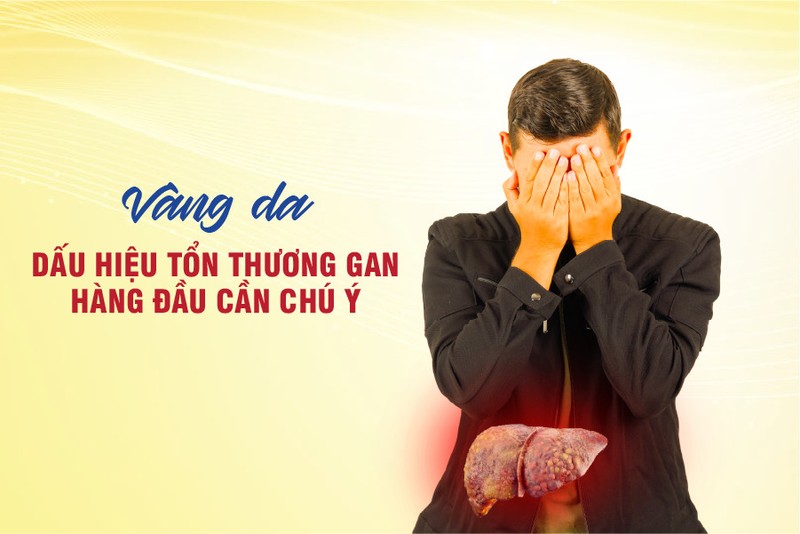 Vang da - Dau hieu ton thuong gan hang dau can chu y