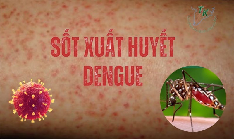 Nguy co sot xuat huyet Dengue bung phat