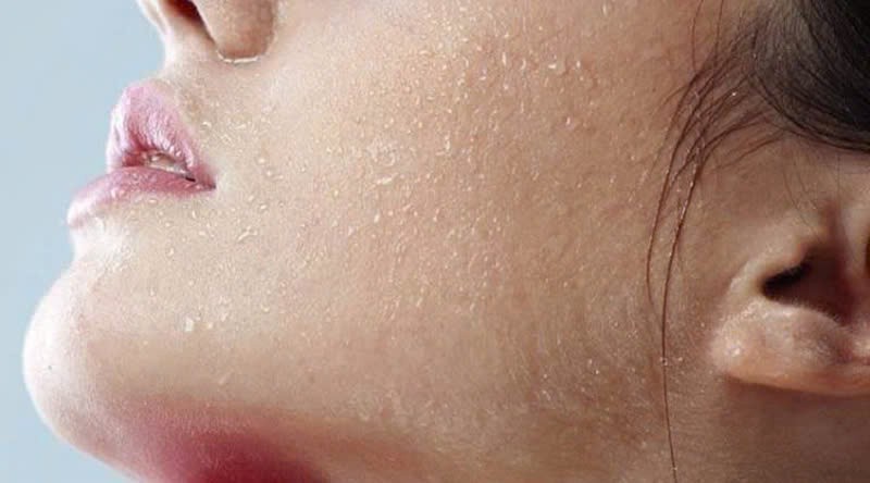 Da khô sần sùi, phải làm sao? - Hình 2 Da kho san sui, phai lam sao?-Hinh-2