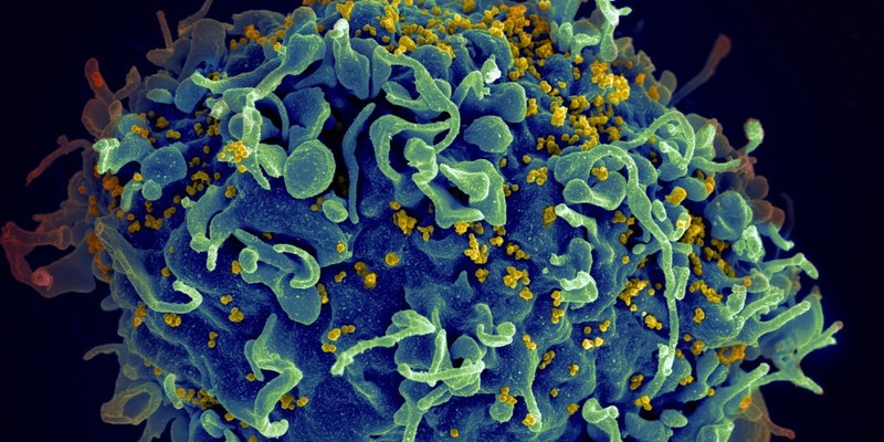 Xuat hien loai virus giong HIV, nguy co lay sang nguoi-Hinh-2
