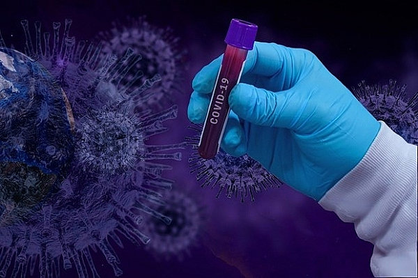 Bat ngo thoi diem virus SARS-CoV-2 “hoanh hanh” manh nhat trong nam-Hinh-7
