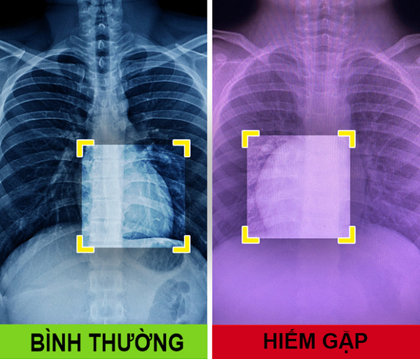 Co nhung dac diem nay, ban chac chan thuoc nhom dac biet nhat the gioi!-Hinh-11