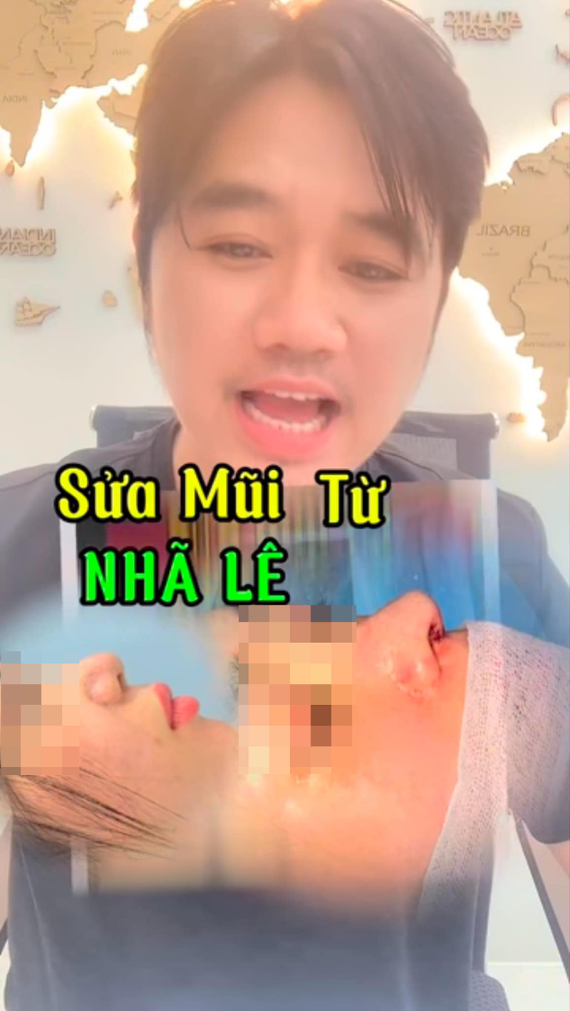 Bat ngo loi khai cua 