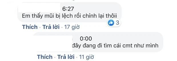 Nam Thu mat bien dang, nghi van tham my hong-Hinh-10