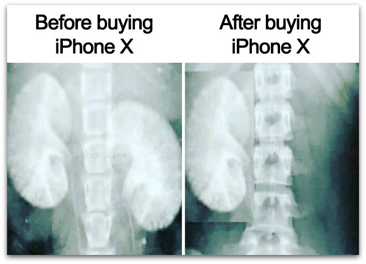 Anh che khi iPhone X ra mat &quot;lay loi&quot; cua dan mang the gioi