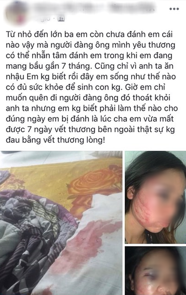 Phan no vo bau 7 thang bi chong nhan tam danh dap khong thuong tiec