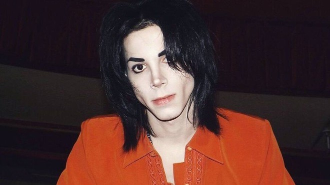 Fans chi nhieu de phau thuat thanh ong hoang nhac pop Michael Jackson
