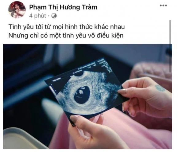 Thuc hu chuyen Huong Tram mang thai sau khi khoe buc anh sieu am