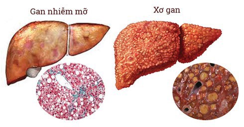 Thoi quen xau nhieu nguoi mac, dang buc tu la gan cua minh