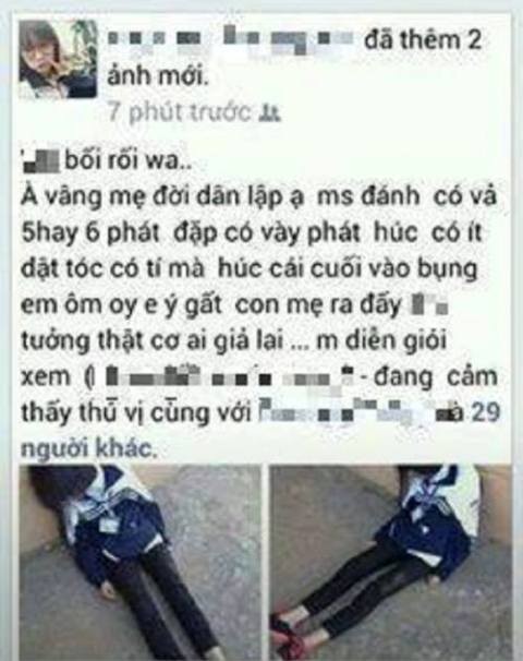 Nu sinh danh ban den ngat xiu roi khoe tren Facebook