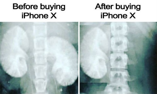 Cuoi dau ruot voi nhung tam anh che iPhone X-Hinh-2