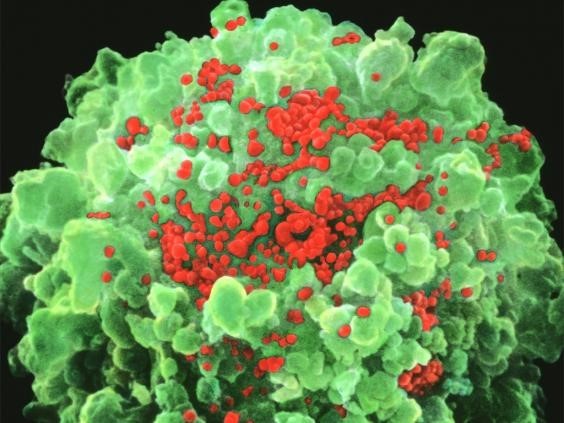 Vaccine AIDS giup 5 benh nhan ‘sach’ HIV trong 7 thang