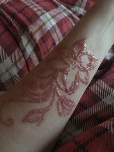 Cô Gái Trẻ Bị Bỏng Hóa Học Mang Sẹo Cả Đời Vì Xăm Hình Henna