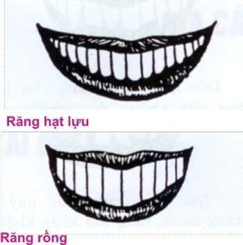 Rang thua kho giu cua, rang cua to van khi hon nguoi