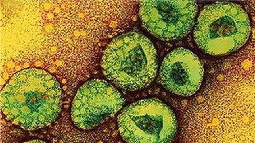 Virus “tử thần” MERS-CoV nguy hiểm như thế nào? Virus “tu than” MERS-CoV nguy hiem nhu the nao?