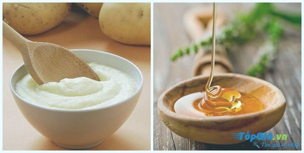 5 loại mặt nạ trị nám từ thiên nhiên hiệu quả tức thì - Hình 9 5 loai mat na tri nam tu thien nhien hieu qua tuc thi-Hinh-9