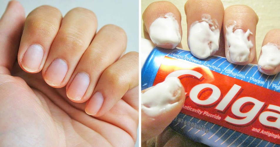 Bí quyết chăm sóc da trẻ mãi của chuyên gia làm đẹp nổi tiếng - Hình 10 Bi quyet cham soc da tre mai cua chuyen gia lam dep noi tieng-Hinh-10