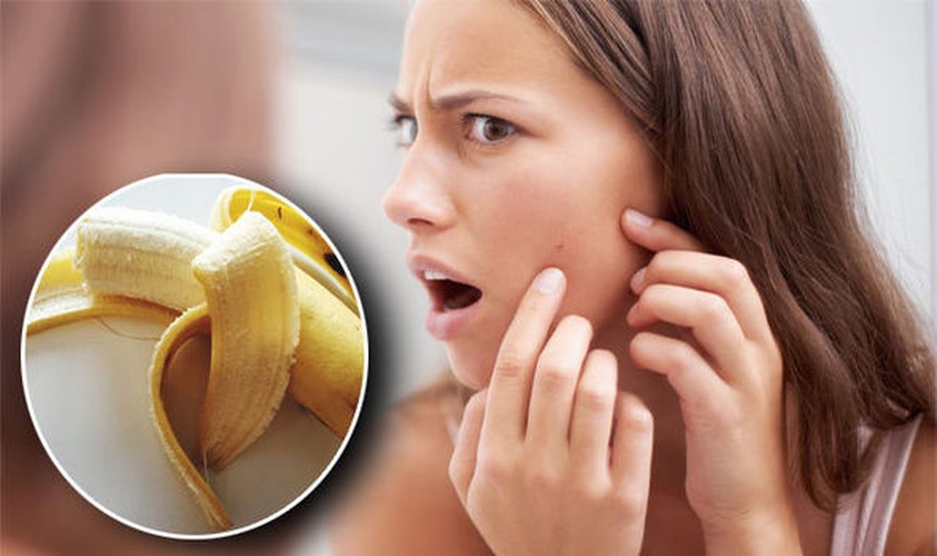 Công dụng kỳ diệu của vỏ chuối ít người biết - Hình 3 Cong dung ky dieu cua vo chuoi it nguoi biet-Hinh-3