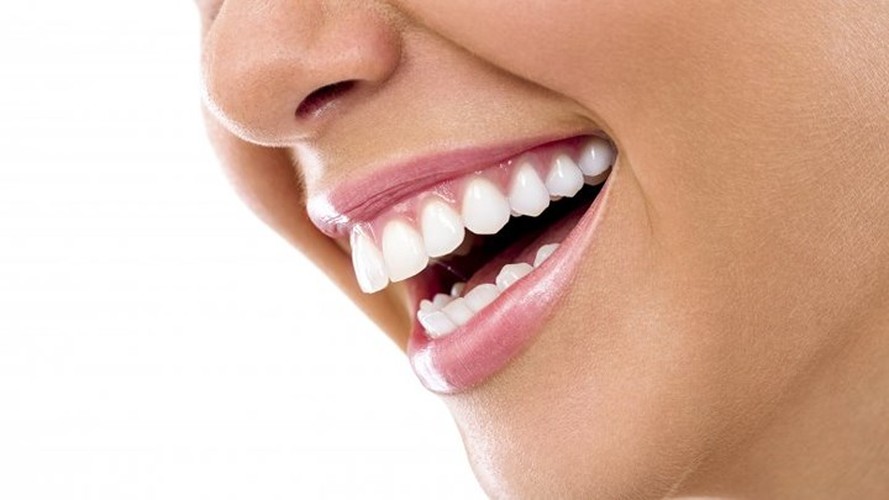 Điều gì xảy ra nếu bạn thường xuyên không đánh răng? - Hình 6 Dieu gi xay ra neu ban thuong xuyen khong danh rang?-Hinh-6