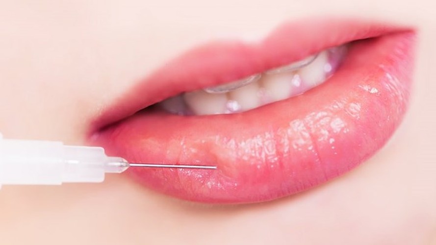 Sự thật tiêm filler môi làm đẹp ít ai biết Su that tiem filler moi lam dep it ai biet