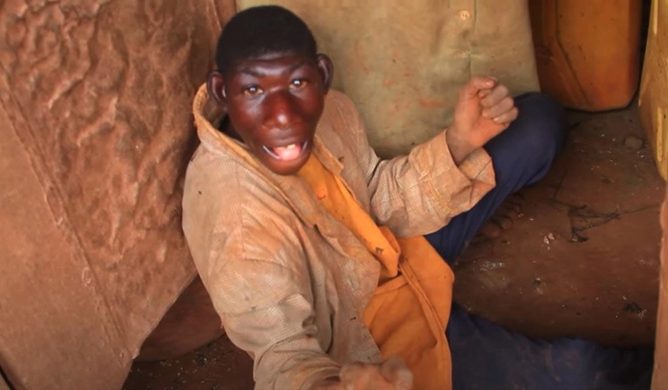 Chang trai khuyet tat chi thich song trong rung o Rwanda-Hinh-4