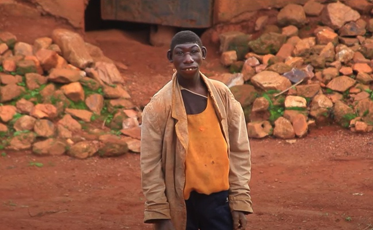 Chang trai khuyet tat chi thich song trong rung o Rwanda