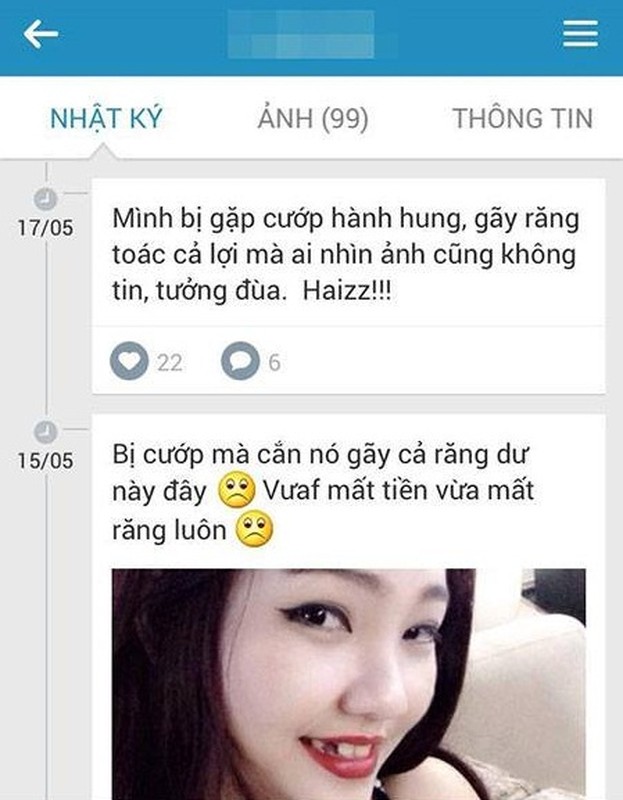 Gai xinh can cuop gay rang, lo mom bi danh bam dap?-Hinh-2